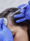 How much does hair loss treatment cost in Bangalore? A professional administering PRP injection for hair restoration.